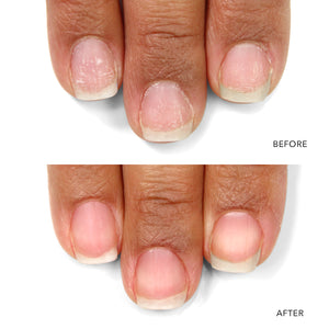 LONDONTOWN Nail Probiotic Instant Boost