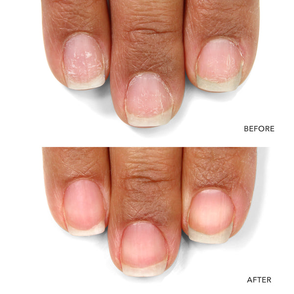 LONDONTOWN Nail Probiotic Instant Boost