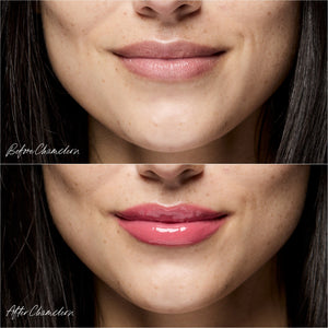 Before and after comparison of a woman's lips with Chameleon lip oil from RMS Beauty..