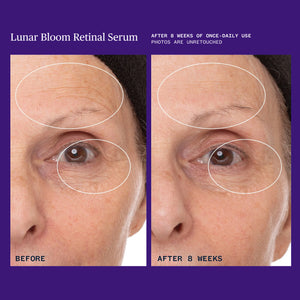 URSA MAJOR Lunar Bloom Retinal Serum